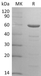 Recombinant HCoV-OC43 Nucleocapsid Protein - ABMIUM