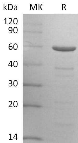 Recombinant HCoV-OC43 Nucleocapsid Protein - ABMIUM