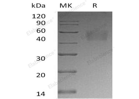 Recombinant Human Nectin-3/PVRL3 Protein (His Tag) - ABMIUM