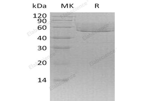 Recombinant Mouse CX3CL1/Fractalkine Protein (His Tag) - ABMIUM