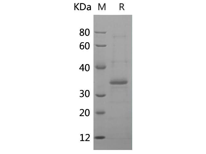 SDS-PAGE analysis of Human HO1 proteins, 2 μg/lane of Recombinant Human HO1 proteins was resolved with SDS-PAGE under reducing conditions, showing bands at 35 kDa.