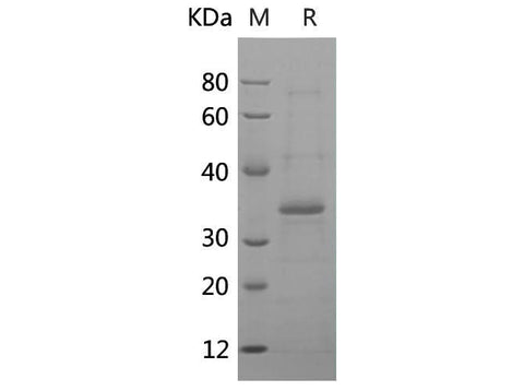 SDS-PAGE analysis of Human HO1 proteins, 2 μg/lane of Recombinant Human HO1 proteins was resolved with SDS-PAGE under reducing conditions, showing bands at 35 kDa.