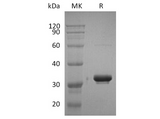 Recombinant Human IgG2-Fc Protein - ABMIUM