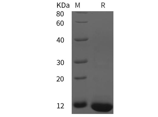 SDS-PAGE analysis of Human NANOG proteins, 2 μg/lane of Recombinant Human NANOG proteins was resolved with SDS-PAGE under reducing conditions, showing bands at 12 kDa.