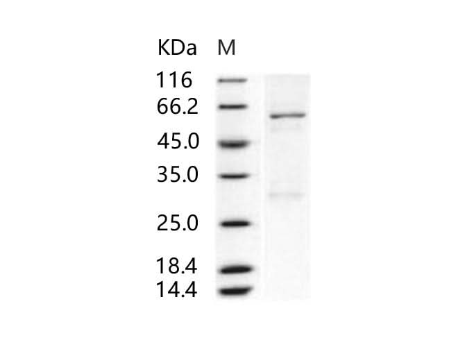 > 85 % as determined by reducing SDS-PAGE.