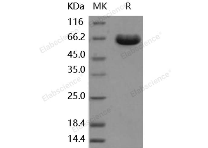 Recombinant Human ESAM Protein (aa 1-248, Fc Tag) - ABMIUM