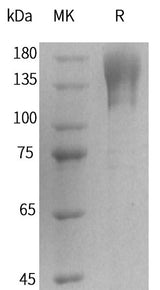 Recombinant Human T-cell Surface Protein Tactile/CD96(C-Fc) - ABMIUM