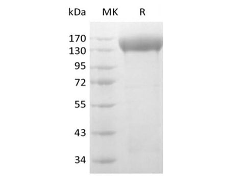 Recombinant Human VEGF Receptor 2/VEGF R2/FLK-1/KDR (C-6His-Avi) Biotinylated - ABMIUM