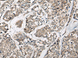 Anti-Human/Mouse/Rat CACNB3 Antibody - ABMIUM