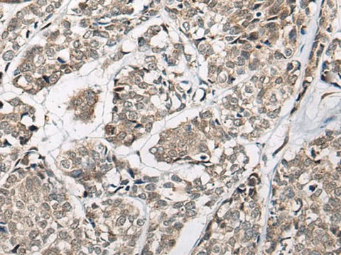 Anti-Human/Mouse/Rat CACNB3 Antibody - ABMIUM