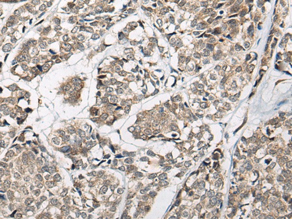 Anti-Human/Mouse/Rat CACNB3 Antibody - ABMIUM
