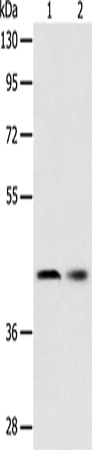 Anti-Human SERPINA5 Antibody - ABMIUM