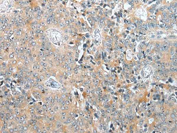 Anti-Human/Mouse COMMD6 Antibody