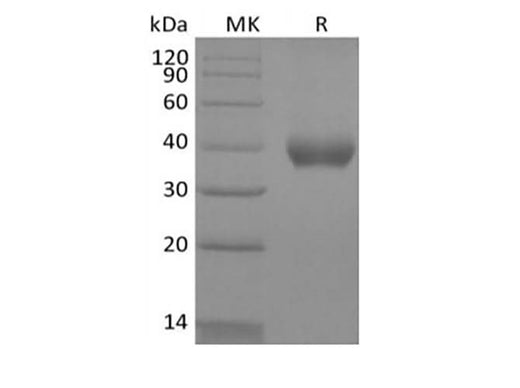 Recombinant Human IL-2 Receptor Subunit Beta/IL-2RB/CD122 (C-6His-Avi) Biotinylated - ABMIUM