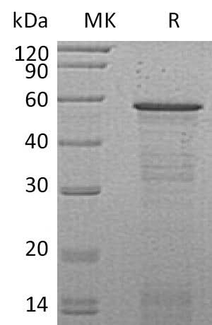 Recombinant Mouse Host Cell Factor 2/HCFC2 Protein (His Tag) - ABMIUM