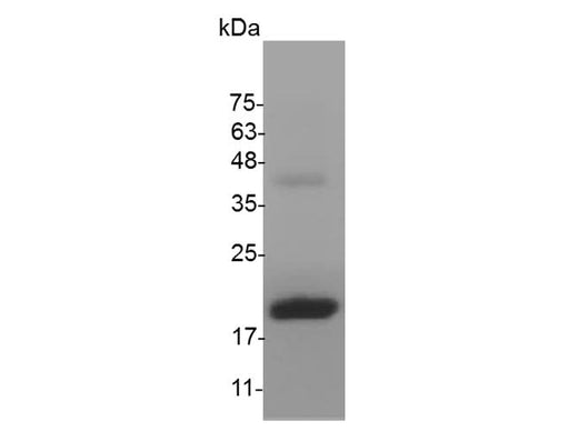 > 98 % as determined by reducing SDS-PAGE.