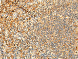 Immunohistochemistry of paraffin-embedded Human tonsil tissue using PPM1B Polyclonal Antibody at dilution of 1:50(×200)
