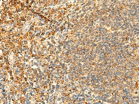 Immunohistochemistry of paraffin-embedded Human tonsil tissue using PPM1B Polyclonal Antibody at dilution of 1:50(×200)