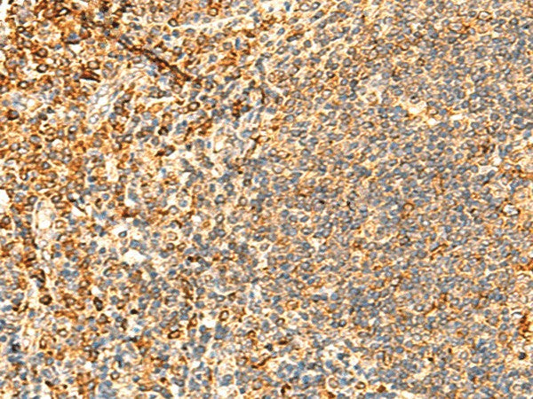 Immunohistochemistry of paraffin-embedded Human tonsil tissue using PPM1B Polyclonal Antibody at dilution of 1:50(×200)