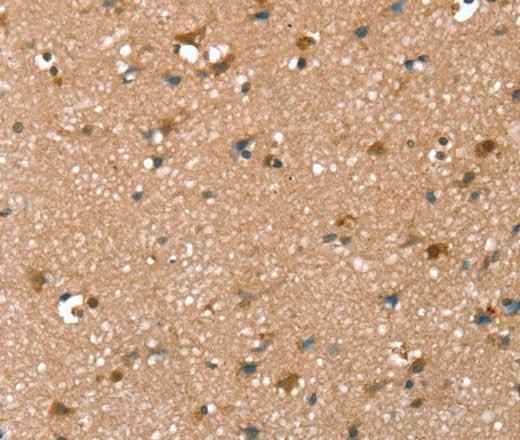 Anti-Human SYNPO2 Antibody