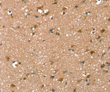 Anti-Human SYNPO2 Antibody - ABMIUM