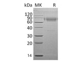 Recombinant Mouse IL18BP Protein (Fc Tag) - ABMIUM
