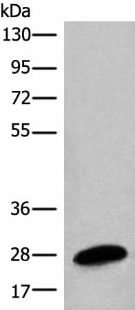 Western blot analysis of Human placenta tissue lysate using BPGM Polyclonal Antibody at dilution of 1:1350