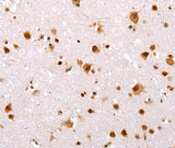 Anti-Human/Mouse TBX2 Antibody - ABMIUM