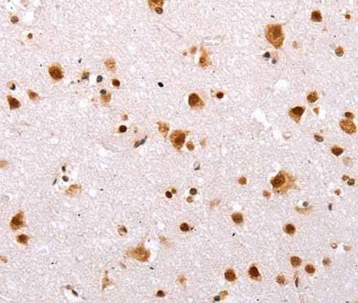 Anti-Human/Mouse TBX2 Antibody
