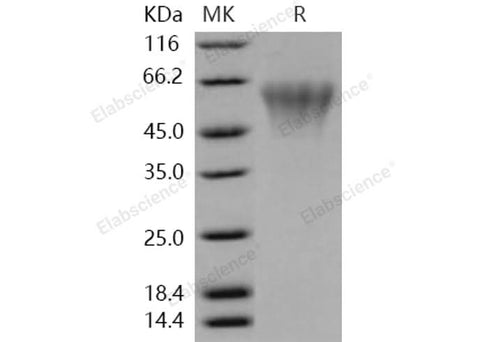 Recombinant Human TREML2/TLT2 Protein (His Tag) - ABMIUM