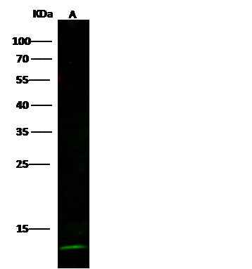 Anti-Human CSTA Antibody [B260] - ABMIUM