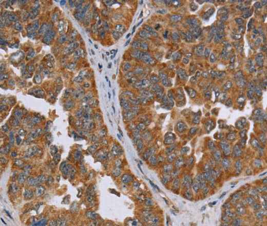 Anti-Human/Mouse ADAMTS15 Antibody
