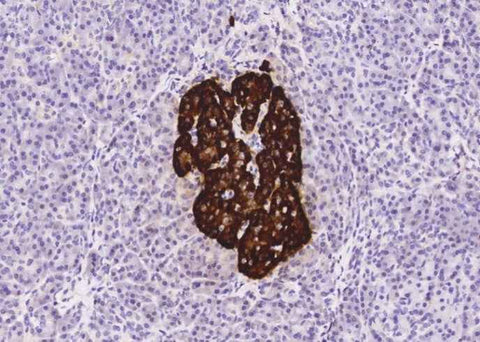 Anti-Human CHGA Antibody [A1182] - ABMIUM