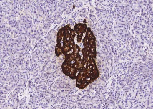 Anti-Human CHGA Antibody [A1182] - ABMIUM