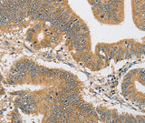 Anti-Human/Mouse/Rat ARHGAP15 Antibody - ABMIUM