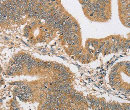 Anti-Human/Mouse/Rat ARHGAP15 Antibody