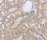 Anti-Human/Mouse/Rat BST1 Antibody - ABMIUM