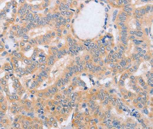 Anti-Human/Mouse/Rat BST1 Antibody