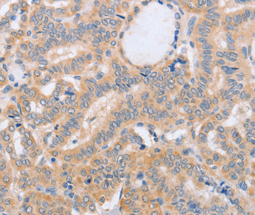 Anti-Human/Mouse/Rat BST1 Antibody - ABMIUM