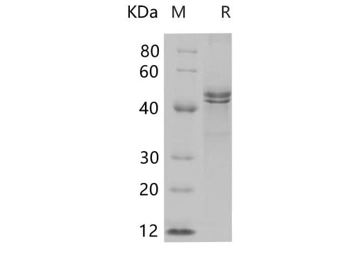 SDS-PAGE analysis of Human CD75/ST6GAL1 proteins, 2 μg/lane of Recombinant Human CD75/ST6GAL1 proteins was resolved with SDS-PAGE under reducing conditions, showing bands at 45.9 kDa.