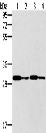 Anti-Human/Mouse/Rat PNMT Antibody - ABMIUM
