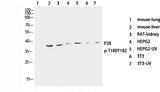 Western Blot analysis of various cells with Phospho-p38 (Thr180/Tyr182) Polyclonal Antibody at dilution of 1:1000