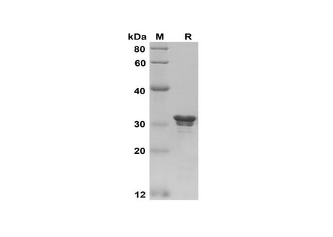 SDS-PAGE analysis of Human Galectin-3 proteins, 2 μg/lane of Recombinant Human Galectin-3 proteins was resolved with SDS-PAGE under reducing conditions, showing bands at 32 kDa.