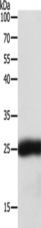 Anti-Human/Mouse/Rat SNAP25 Antibody - ABMIUM