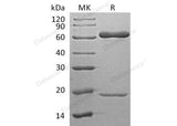 Recombinant Human PCSK9 Protein (His Tag) - ABMIUM