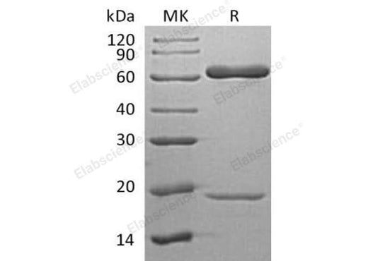 Recombinant Human PCSK9 Protein (His Tag) - ABMIUM