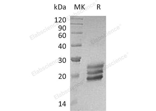 Recombinant Human Interleukin-25/IL-25 Protein (His Tag) - ABMIUM