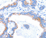 Anti-Human/Mouse SMG8 Antibody - ABMIUM