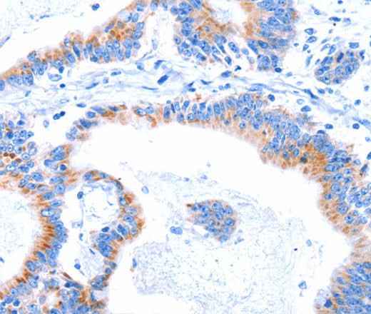 Anti-Human/Mouse SMG8 Antibody