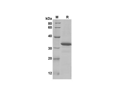 SDS-PAGE analysis of Mouse CCL9/10/MIP-1γ proteins, 2 μg/lane of Recombinant Mouse CCL9/10/MIP-1γ proteins was resolved with SDS-PAGE under reducing conditions, showing bands at 34 kDa.